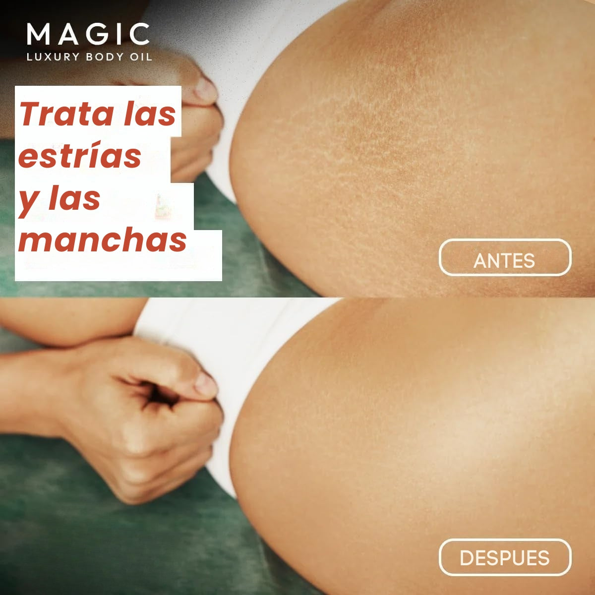 Aceite Corporal Magic™ | Nutre e ilumina tu piel