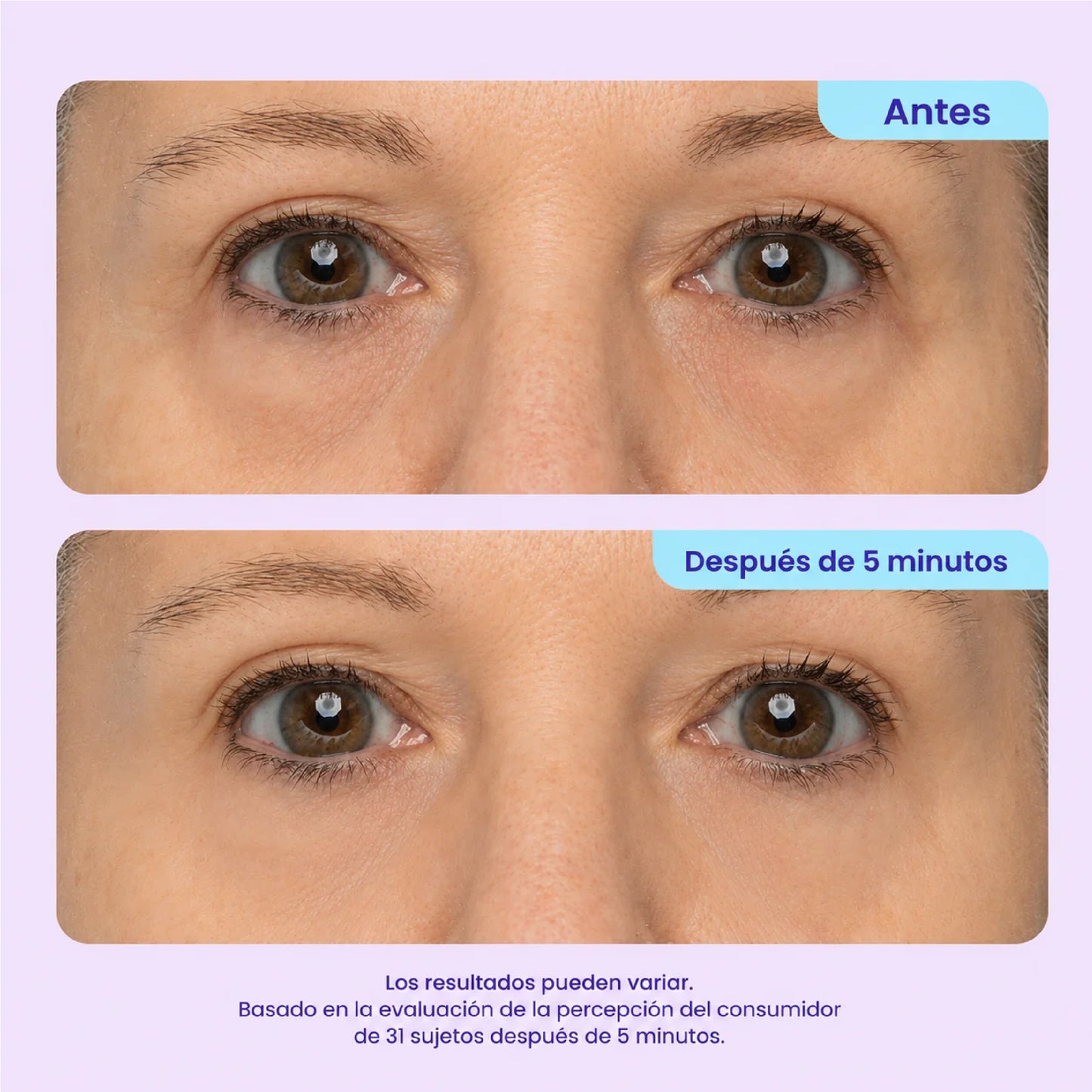 Gopure™ - Contorno de ojos ✨ - OFERTA 2x1
