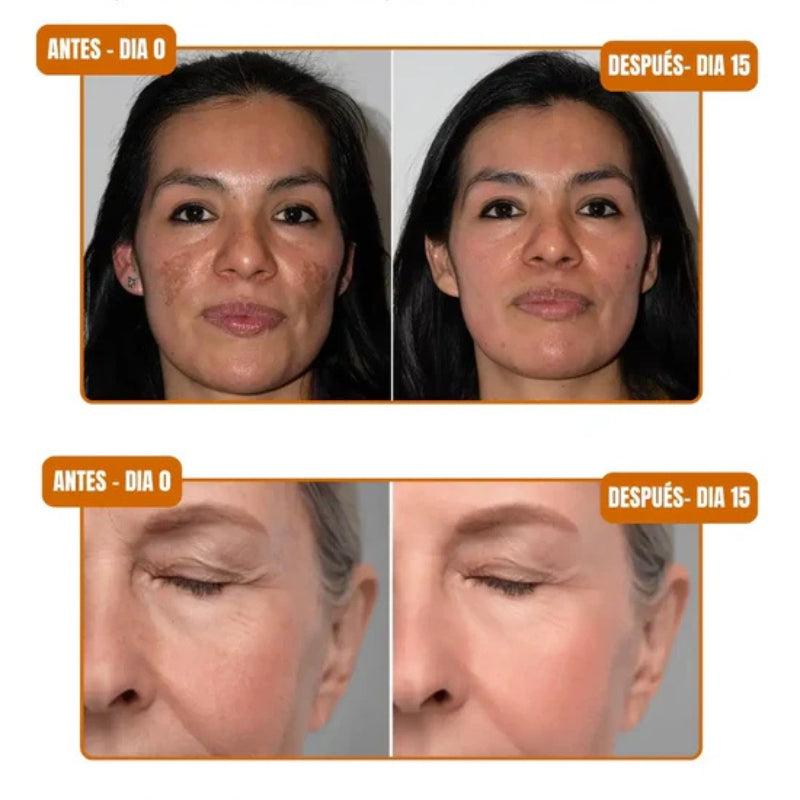 Dermachem - Serum clareador anti melasma - OFERTA 2X1